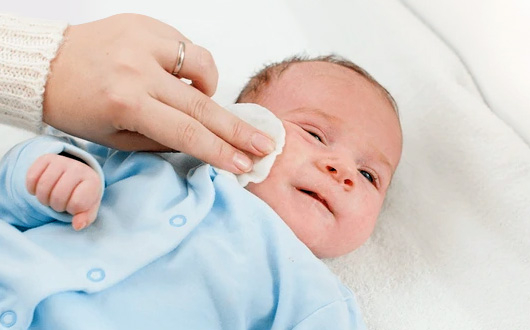 Bebeklerde Göz Sulanması